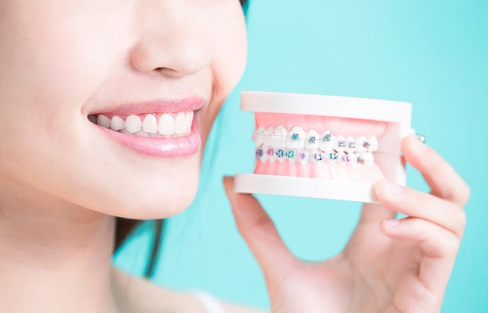 矯正治療を受けるメリット