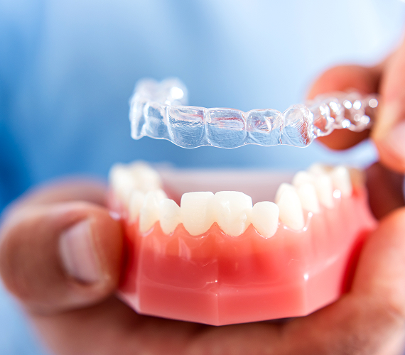 矯正歯科・小児矯正歯科