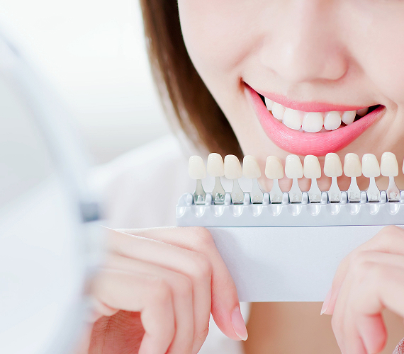 ホワイトニング